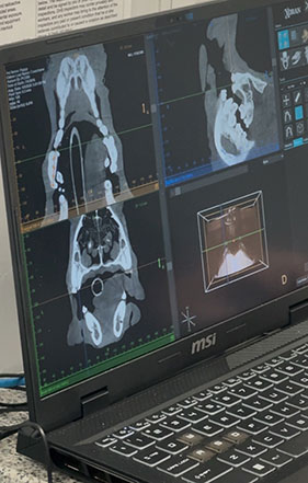 Computed Tomography Dental Scan